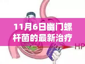 11月6日幽门螺杆菌最新治疗方法探索，开启治疗新纪元