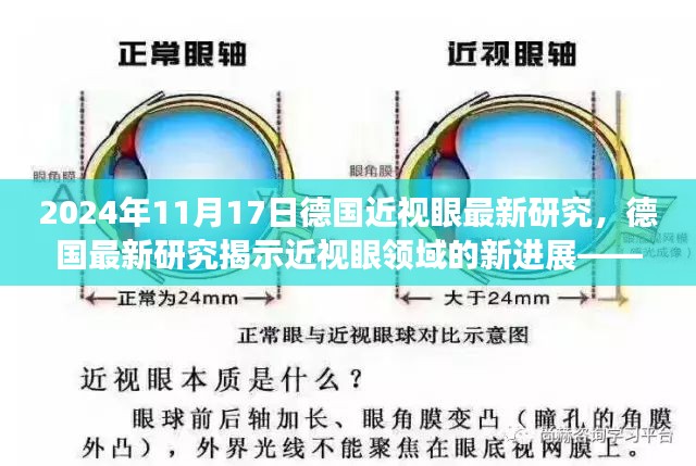 德国最新研究揭示，2024年近视眼领域的新里程碑进展——科学里程碑见证时刻（日期为11月17日）