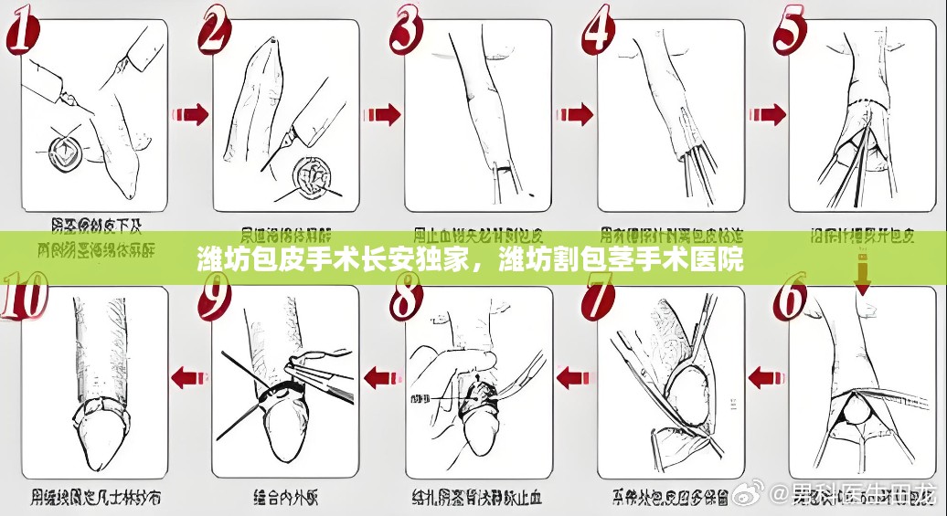 潍坊包皮手术长安独家，潍坊割包茎手术医院 