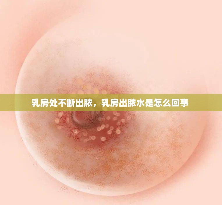 乳房处不断出脓，乳房出脓水是怎么回事 