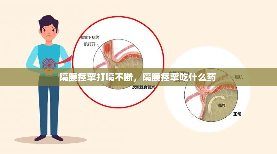 隔膜痉挛打嗝不断，隔膜痉挛吃什么药 